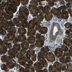 Invitrogen CTR2 Polyclonal Antibody 100 &mu;L; Unconjugated:Antibodies,
