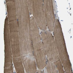 Invitrogen CTR2 Polyclonal Antibody 100 &mu;L; Unconjugated:Antibodies,