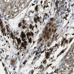 Invitrogen CTR2 Polyclonal Antibody 100 &mu;L; Unconjugated:Antibodies,