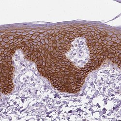 Invitrogen Aquaporin 3 Polyclonal Antibody 100 &mu;L; Unconjugated:Antibodies,