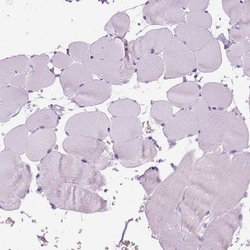 Invitrogen Aquaporin 3 Polyclonal Antibody 100 &mu;L; Unconjugated:Antibodies,