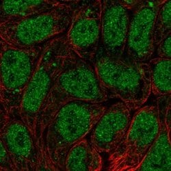 Invitrogen BRI3BP Polyclonal Antibody 100 &mu;L; Unconjugated:Antibodies,