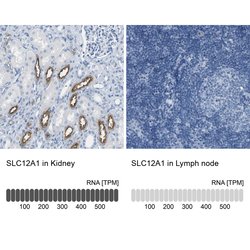 Invitrogen NKCC2 Polyclonal Antibody 100 &mu;L; Unconjugated:Antibodies,