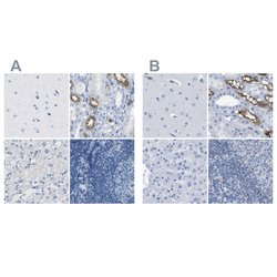 Invitrogen NKCC2 Polyclonal Antibody 100 &mu;L; Unconjugated:Antibodies,