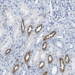 Invitrogen NKCC2 Polyclonal Antibody 100 &mu;L; Unconjugated:Antibodies,