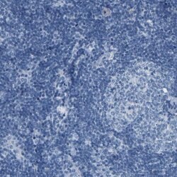 Invitrogen NKCC2 Polyclonal Antibody 100 &mu;L; Unconjugated:Antibodies,