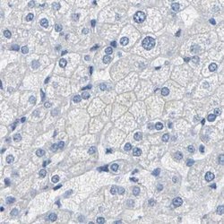 Invitrogen NKCC2 Polyclonal Antibody 100 &mu;L; Unconjugated:Antibodies,