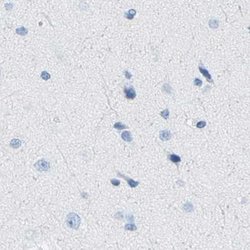 Invitrogen NKCC2 Polyclonal Antibody 100 &mu;L; Unconjugated:Antibodies,