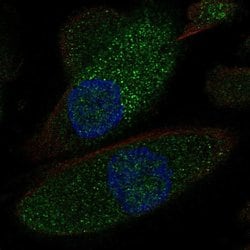 Invitrogen NKCC2 Polyclonal Antibody 100 &mu;L; Unconjugated:Antibodies,