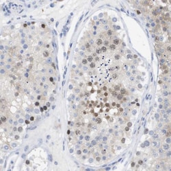 Invitrogen PNMA1 Polyclonal Antibody 100 &mu;L; Unconjugated:Antibodies,