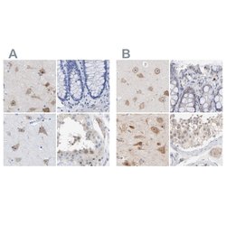 Invitrogen PNMA1 Polyclonal Antibody 100 &mu;L; Unconjugated:Antibodies,