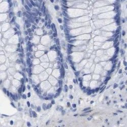 Invitrogen PNMA1 Polyclonal Antibody 100 &mu;L; Unconjugated:Antibodies,