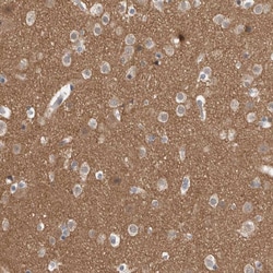 Invitrogen LPHN3 Polyclonal Antibody 100 &mu;L; Unconjugated:Antibodies,