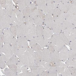 Invitrogen LPHN3 Polyclonal Antibody 100 &mu;L; Unconjugated:Antibodies,