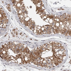 Invitrogen LPHN3 Polyclonal Antibody 100 &mu;L; Unconjugated:Antibodies,