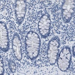 Invitrogen EQTN Polyclonal Antibody 100 &mu;L; Unconjugated:Antibodies,