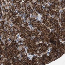 Invitrogen DENND4C Polyclonal Antibody 100 μL; Unconjugated:Antibodies,