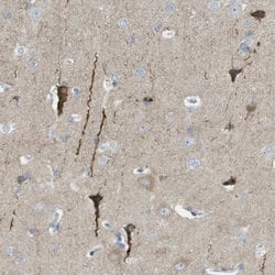 Invitrogen PTPRZ Polyclonal Antibody 100 &mu;L | Buy Online | Invitrogen&trade; | Fisher Scientific