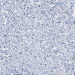 Invitrogen PTPRZ Polyclonal Antibody 100 &mu;L | Buy Online | Invitrogen&trade; | Fisher Scientific