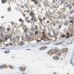 Invitrogen UGGT1 Polyclonal Antibody 100 &mu;L; Unconjugated:Antibodies,