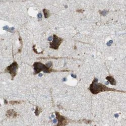 Invitrogen UGGT1 Polyclonal Antibody 100 &mu;L; Unconjugated:Antibodies,