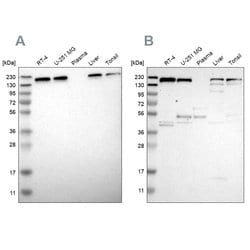Invitrogen UGGT1 Polyclonal Antibody 100 &mu;L; Unconjugated:Antibodies,