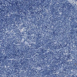 Invitrogen B4GALNT1 Polyclonal Antibody 100 &mu;L; Unconjugated:Antibodies,