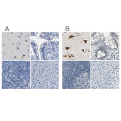 Invitrogen B4GALNT1 Polyclonal Antibody 100 &mu;L; Unconjugated:Antibodies,