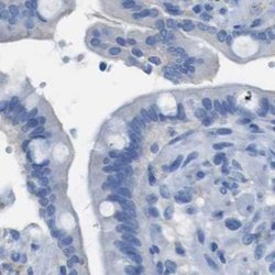 Invitrogen B4GALNT1 Polyclonal Antibody 100 &mu;L; Unconjugated:Antibodies,