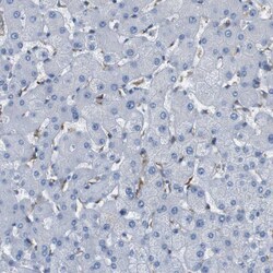 Invitrogen FCGRT Polyclonal Antibody 100 &mu;L; Unconjugated:Antibodies,