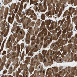 Invitrogen&trade;&nbsp;SLC41A1 Polyclonal Antibody