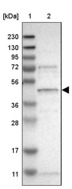 Invitrogen SLC41A1 Polyclonal Antibody 100 &mu;L | Buy Online | Invitrogen&trade; | Fisher Scientific
