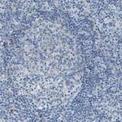Invitrogen KCTD3 Polyclonal Antibody 100 &mu;L | Buy Online | Invitrogen&trade; | Fisher Scientific