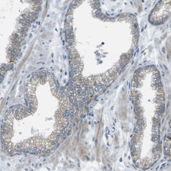 Invitrogen KCTD3 Polyclonal Antibody 100 &mu;L | Buy Online | Invitrogen&trade; | Fisher Scientific