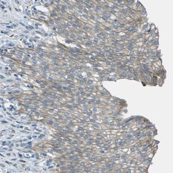 Invitrogen KCTD3 Polyclonal Antibody 100 &mu;L | Buy Online | Invitrogen&trade; | Fisher Scientific