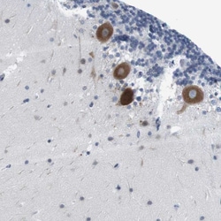 Invitrogen ERGIC3 Polyclonal Antibody 100 &mu;L; Unconjugated:Antibodies,
