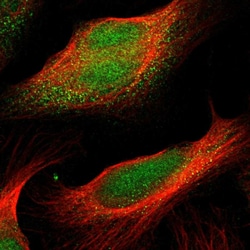 Invitrogen PFTK1 Polyclonal Antibody 100 &mu;L; Unconjugated:Antibodies,
