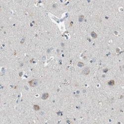 Invitrogen PFTK1 Polyclonal Antibody 100 &mu;L; Unconjugated:Antibodies,