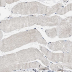 Invitrogen PFTK1 Polyclonal Antibody 100 &mu;L; Unconjugated:Antibodies,