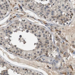 Invitrogen PFTK1 Polyclonal Antibody 100 &mu;L; Unconjugated:Antibodies,