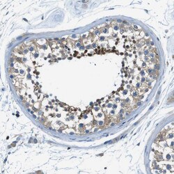 Invitrogen TES Polyclonal Antibody 100 &mu;L; Unconjugated:Antibodies,