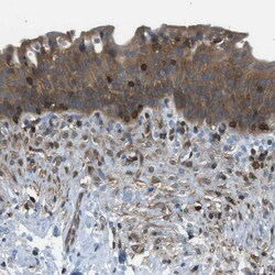 Invitrogen TES Polyclonal Antibody 100 &mu;L; Unconjugated:Antibodies,