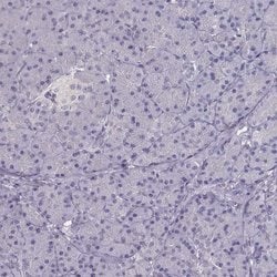 Invitrogen NDRG4 Polyclonal Antibody 100 &mu;L; Unconjugated:Antibodies,