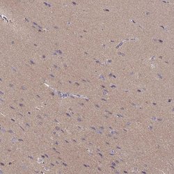 Invitrogen NDRG4 Polyclonal Antibody 100 &mu;L; Unconjugated:Antibodies,