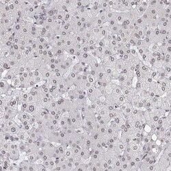 Invitrogen ZNF532 Polyclonal Antibody 100 &mu;L | Buy Online | Invitrogen&trade; | Fisher Scientific