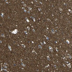 Invitrogen PCTAIRE2 Polyclonal Antibody 100 &mu;L; Unconjugated:Antibodies,