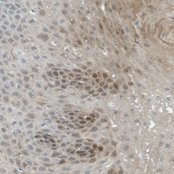 Invitrogen SERPINB2 Polyclonal Antibody 100 &mu;L; Unconjugated:Antibodies,