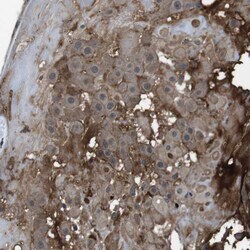 Invitrogen CDH20 Polyclonal Antibody 100 &mu;L; Unconjugated:Antibodies,
