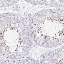 Invitrogen EQTN Polyclonal Antibody 100 &mu;L; Unconjugated:Antibodies,
