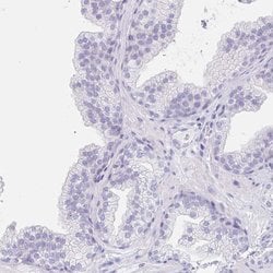 Invitrogen EQTN Polyclonal Antibody 100 &mu;L; Unconjugated:Antibodies,